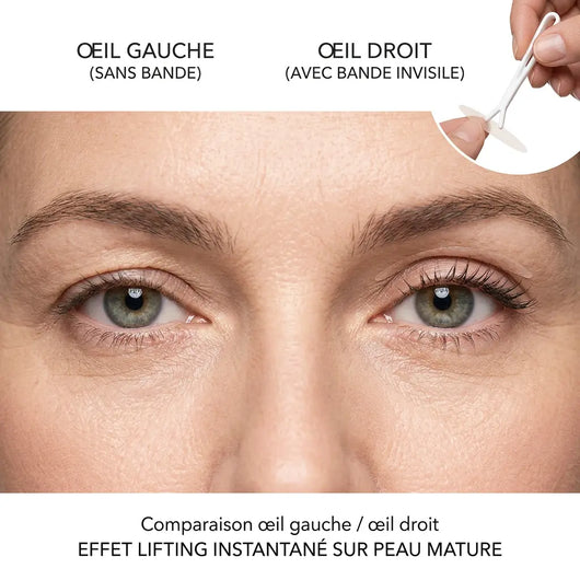 Lumonix™ Eyelid Corrective Strips